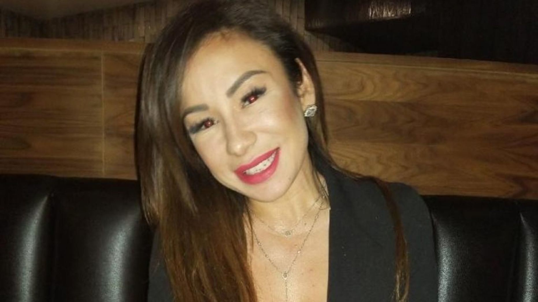 Estetik ameliyat nedeniyle hayatını kaybeden kadın
