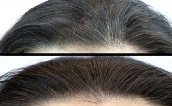 Saçlardaki Beyazlıkları Kapatmanın 100 de 100 Doğal Çözümleri !